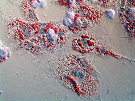 Hypatocyte lipid droplets