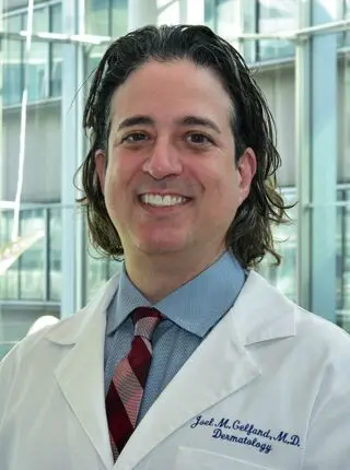Joel M. Gelfand, MD, MSCE