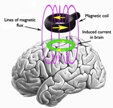 Transcranial magnetic stimulation (TMS) graphic
