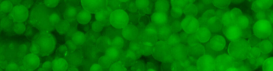 Bodipy-stained 3D-cultured primary human adipocytes