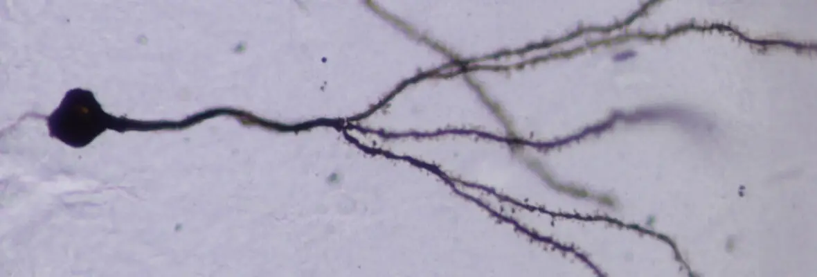 Neuron Golgi Stain
