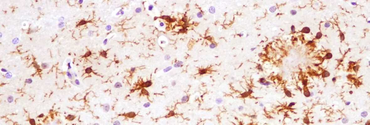Microglia around amyloid plaque