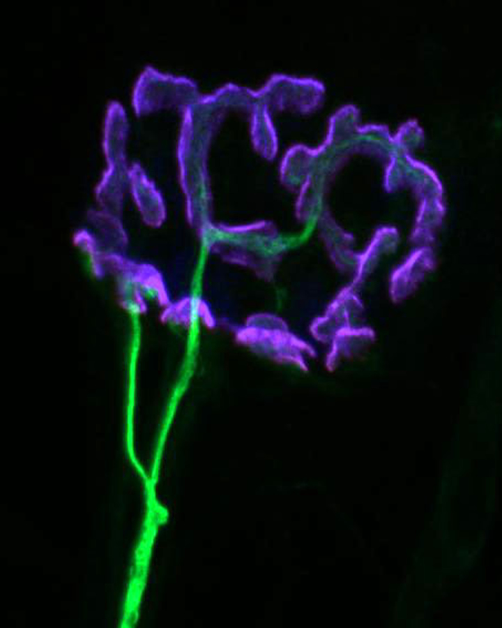neuromuscular junction taken at 60x on a confocal
