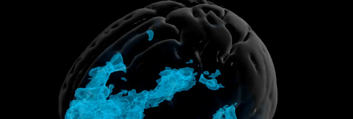 3D rendering of a human brain with highlighted blue regions representing neural activity