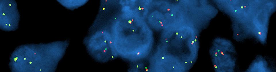 OCRC Tumor Bank Core
