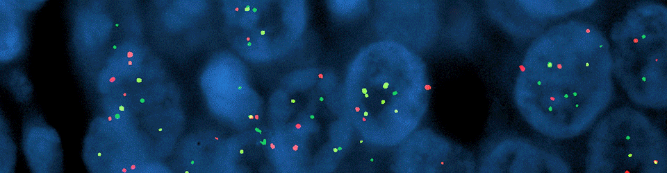 OCRC Tumor Bank Core