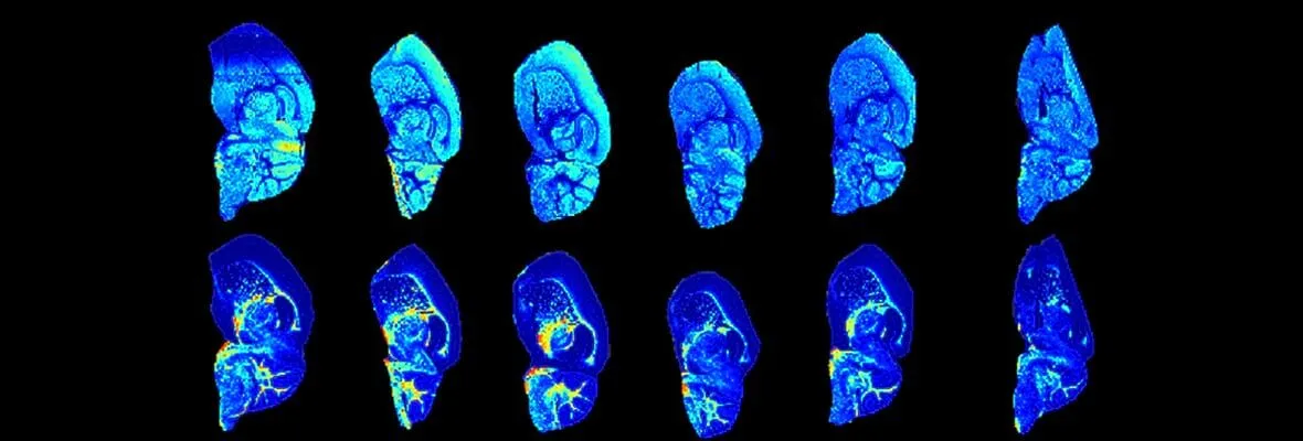 Saggital sections of a mouse brain imaged with Mass spectrometry imaging