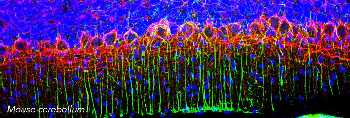 Mouse cerebellum