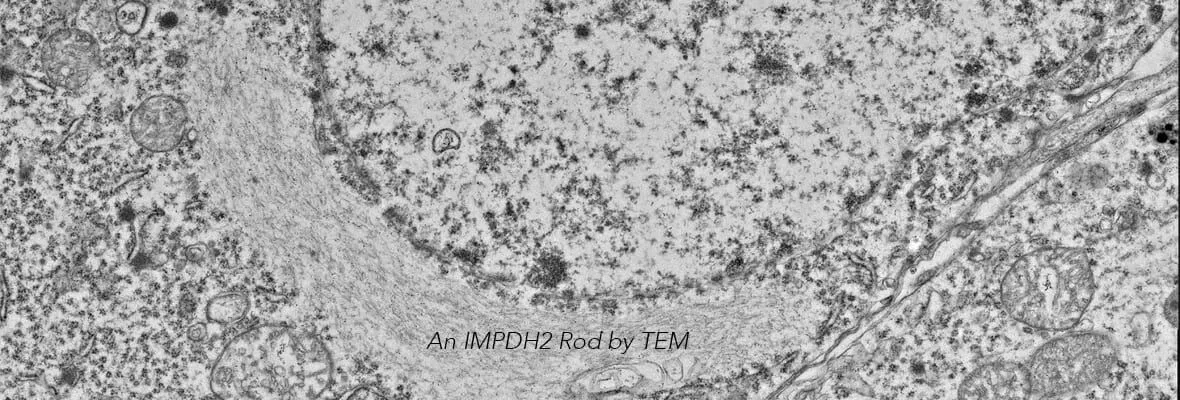 IMPDH2 rod imaged by TEM