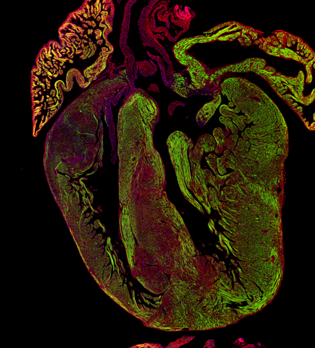 image of fluorescent heart