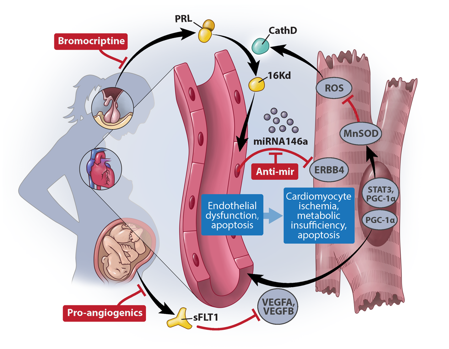 illustration of postpartum cardiomyopathy