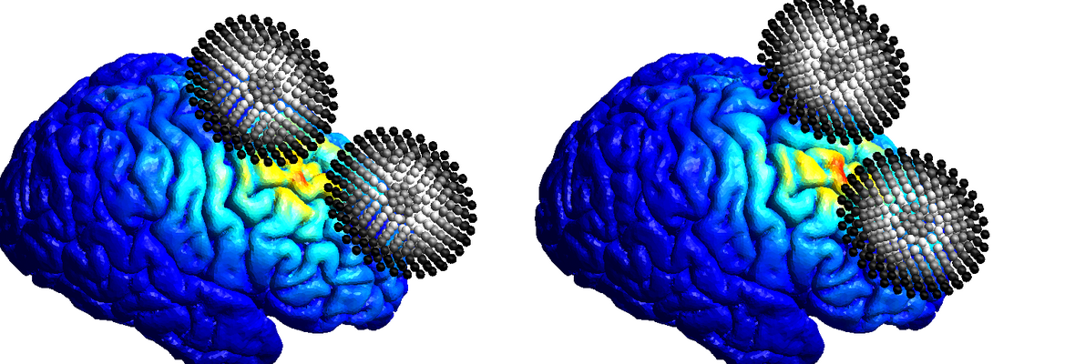 brain neuroimaging