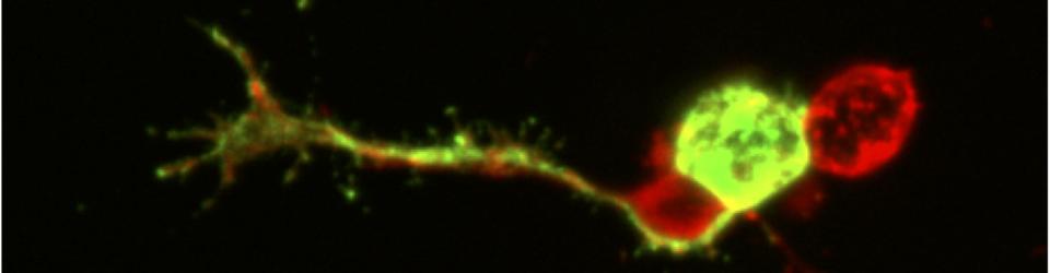 Primary Drosophila neuron culture