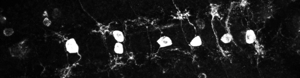 Sparse labeling of Drosophila Motor Neurons