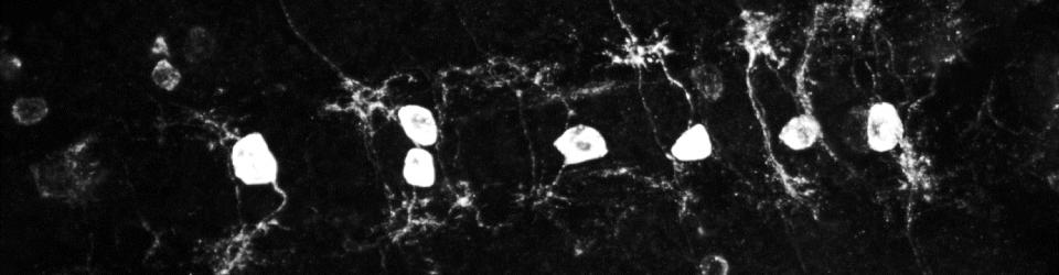 Sparse labeling of embryonic motor neurons