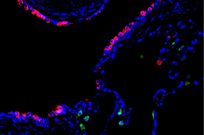 A human Respiratory Bronchiole