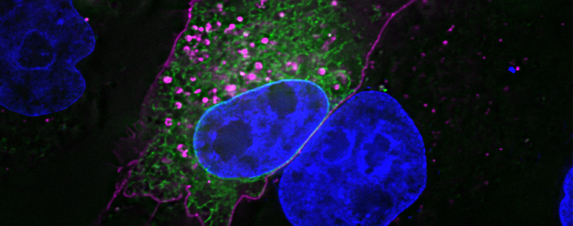 Immunofluorescence viral trafficking