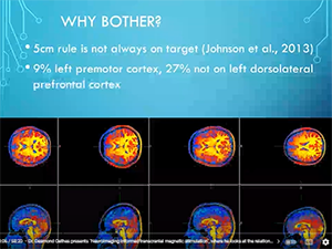 brainSTIM Mini Neuromodulation Symposium Screenshot