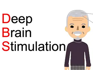 Neuromodec Deep Brain Stimulation Graphic