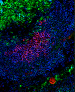 Confocal micrograph illustrating