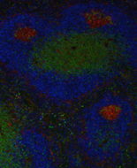 Confocal micrograph illustrating