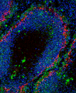 Confocal micrograph illustrating