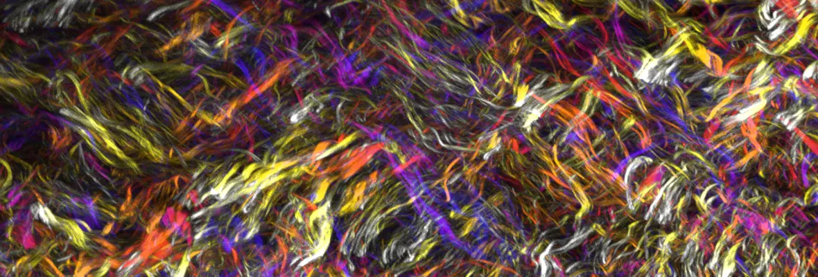 second harmonic generation image of collagen