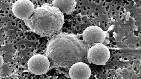 Image result for EM microscopy images