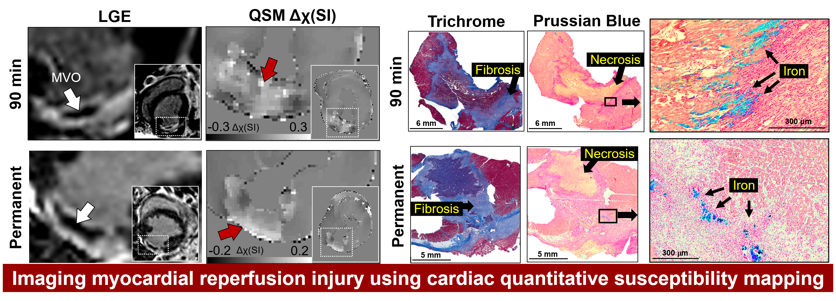 quantitative susceptibility mapping
