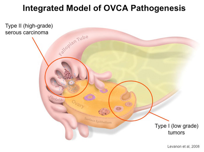 A scientific illustration titled "Integrated model of OVCA pathogenesis" from Levanon et al., 2008