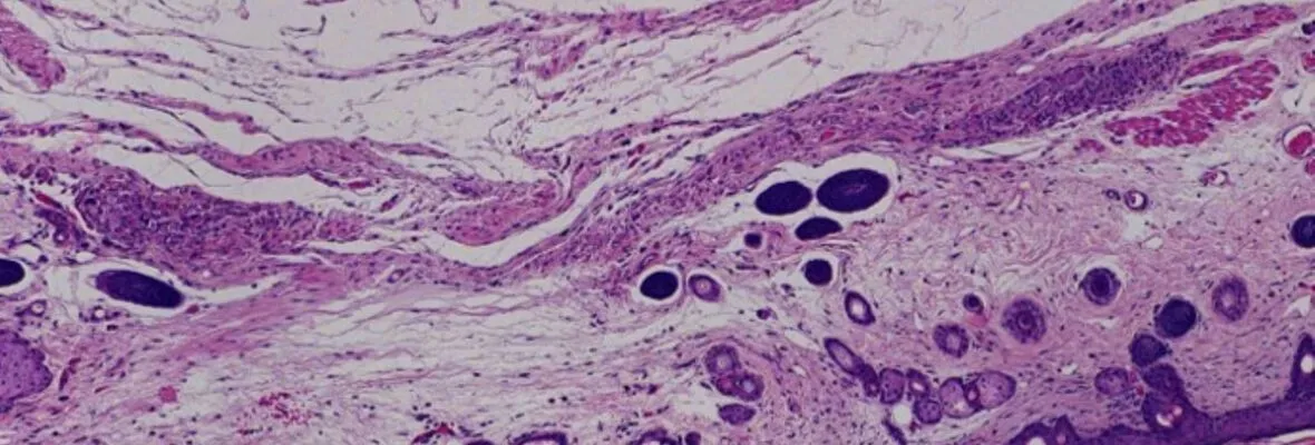 Islet cells under microscope