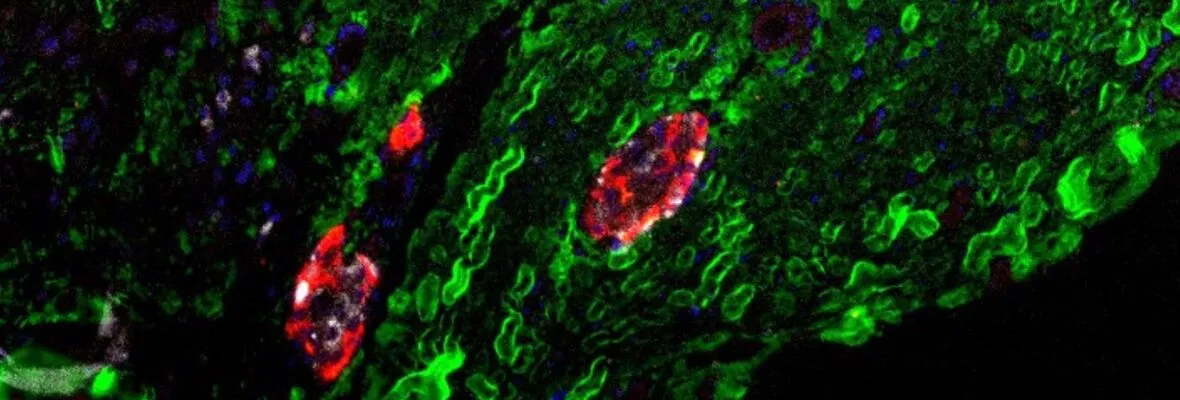 Stained cells under microscope