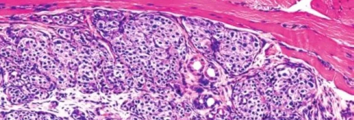 Iselt cells under microscope