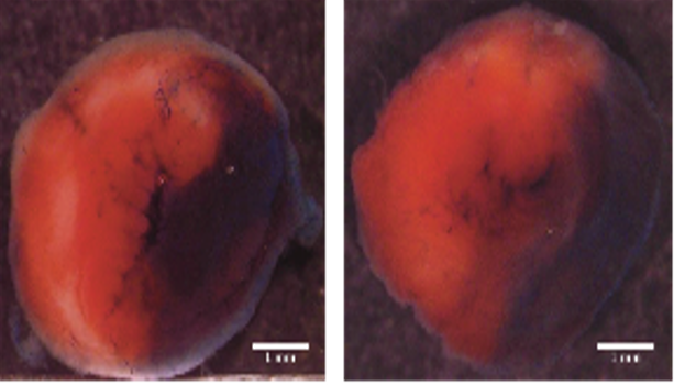 Scherrer-Crosbie Lab Research