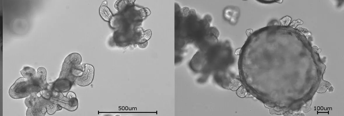 Organoid Images