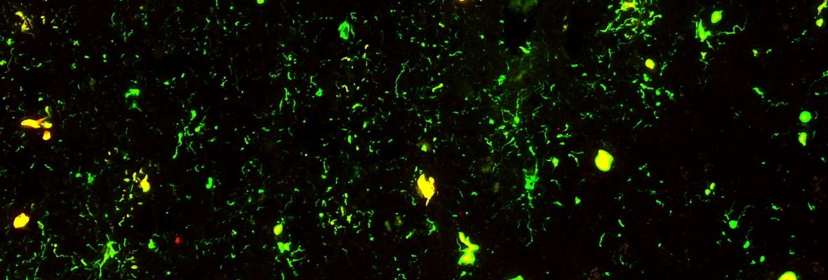 fluorescent stained slide