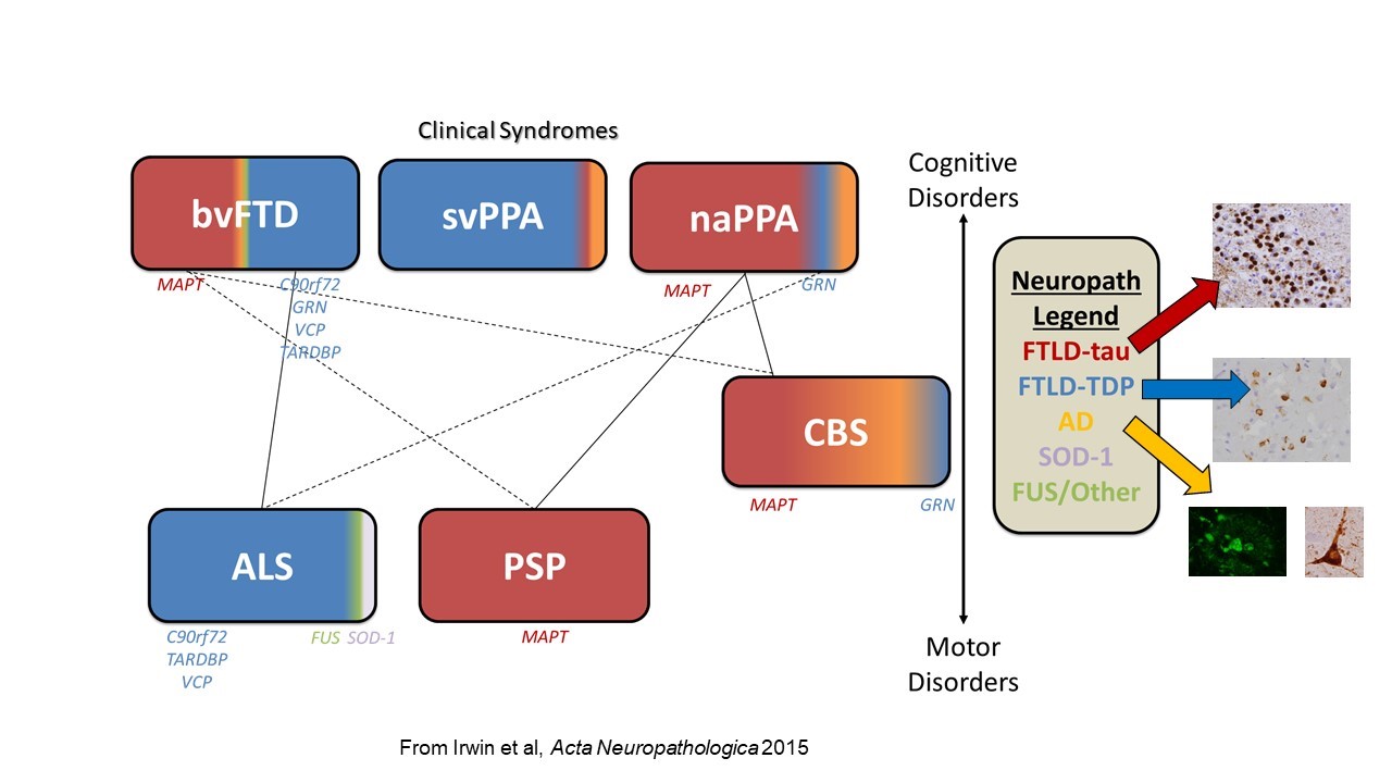 Clinicopathological and genetic associations in FTD