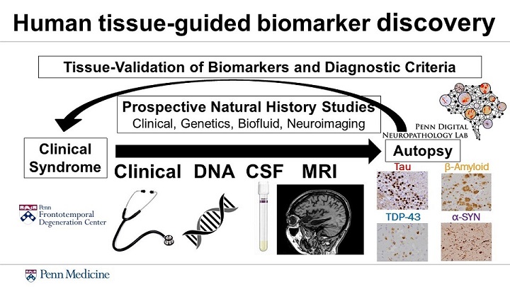 human tissue-guided biomarker discovery