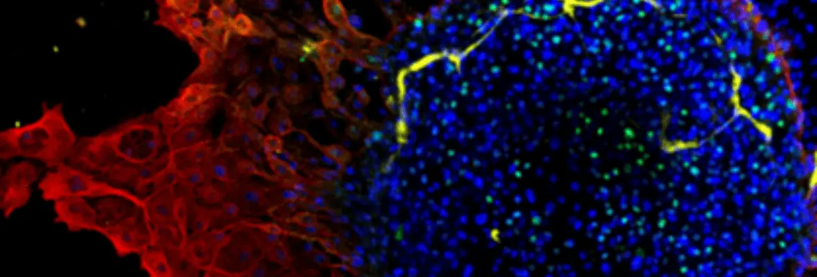 Zoomed in colorful image of an Organoid.