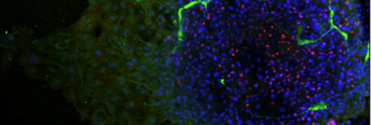 Zoomed in blue and green colored Organoid.