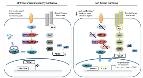 Hippo pathway in soft tissue sarcomas diagram