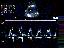 Tricuspid Valve Inflow by Pulse Doppler - 27 weeks