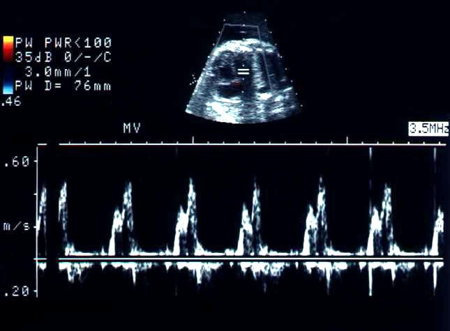 Fetal Echocardiography Homepage