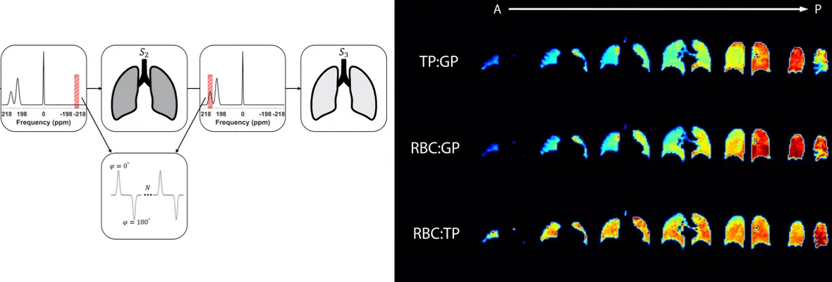 Xenon-Polarization Transfer Contrast