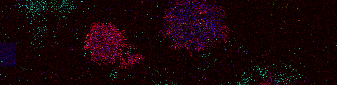 Eric Sanford, Raj Lab, drug-resistant colonies of melanoma cells