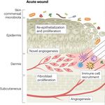 The wound microbiota: microbial mechanisms of impaired wound healing and infection