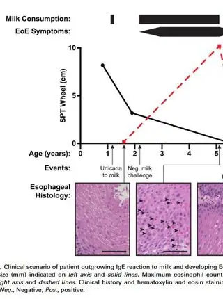 Resolution of acute IgE-mediated allergy with development of eosinophilic esophagitis triggered by the same food