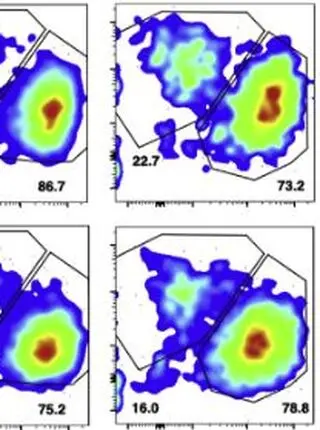 Heterozygous FOXN1 Variants Cause Low TRECs and Severe T Cell Lymphopenia, Revealing a Crucial Role of FOXN1 in Supporting Early Thymopoiesis