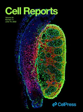 Inflammatory adipose activates a nutritional immunity pathway leading to retinal dysfunction