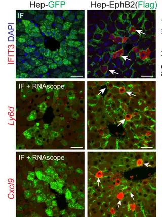 Hepatocytes demarcated by EphB2 contribute to the progression of nonalcoholic steatohepatitis